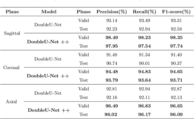 Figure 4 for DoubleU-Net++: Architecture with Exploit Multiscale Features for Vertebrae Segmentation
