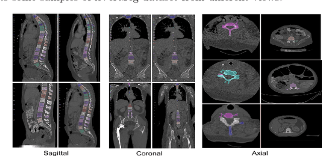 Figure 1 for DoubleU-Net++: Architecture with Exploit Multiscale Features for Vertebrae Segmentation