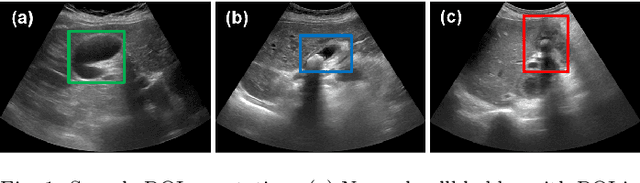 Figure 1 for RadFormer: Transformers with Global-Local Attention for Interpretable and Accurate Gallbladder Cancer Detection