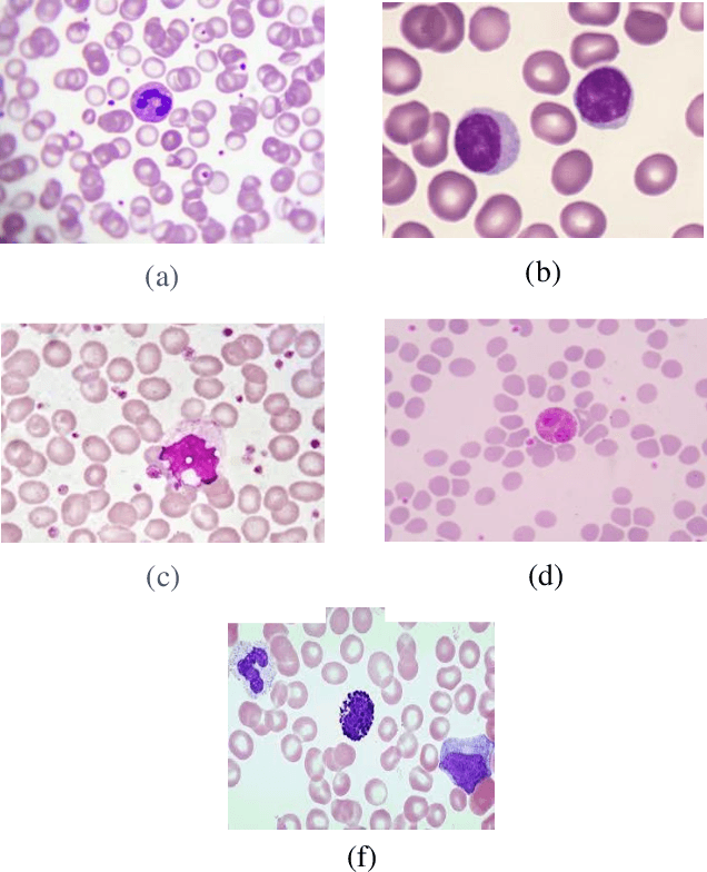 Figure 2 for A Review on Classification of White Blood Cells Using Machine Learning Models