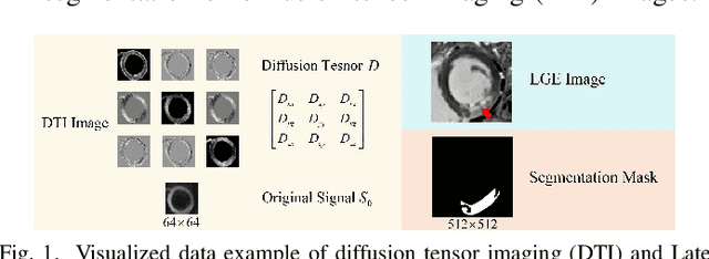 Figure 1 for Style Transfer and Self-Supervised Learning Powered Myocardium Infarction Super-Resolution Segmentation