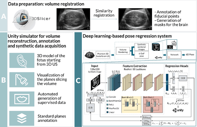 Figure 2 for Learning ultrasound plane pose regression: assessing generalized pose coordinates in the fetal brain