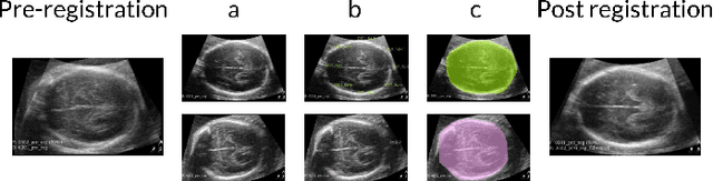 Figure 3 for Learning ultrasound plane pose regression: assessing generalized pose coordinates in the fetal brain