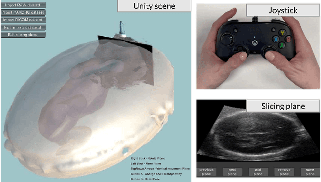 Figure 4 for Learning ultrasound plane pose regression: assessing generalized pose coordinates in the fetal brain