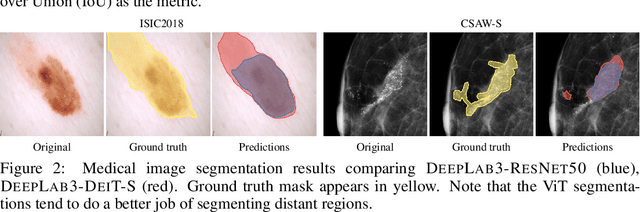 Figure 4 for Pretrained ViTs Yield Versatile Representations For Medical Images