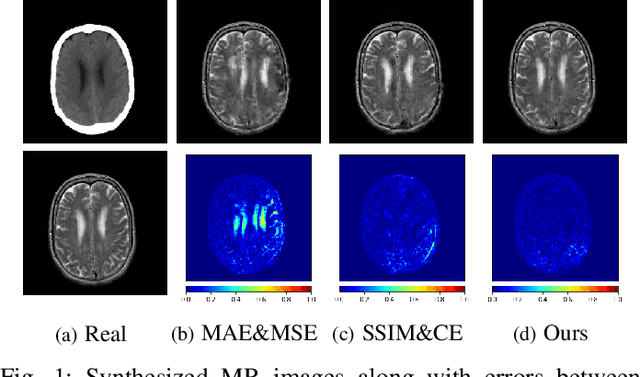Figure 1 for DC-cycleGAN: Bidirectional CT-to-MR Synthesis from Unpaired Data