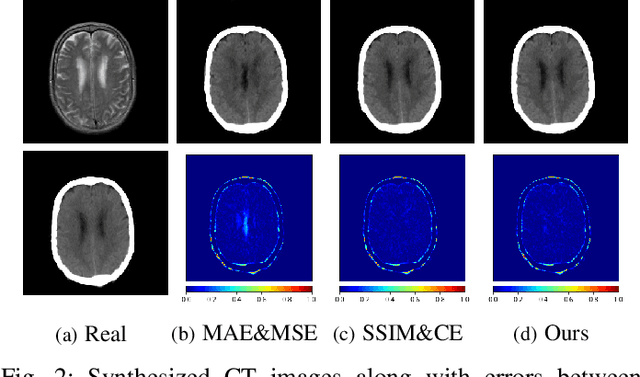 Figure 2 for DC-cycleGAN: Bidirectional CT-to-MR Synthesis from Unpaired Data