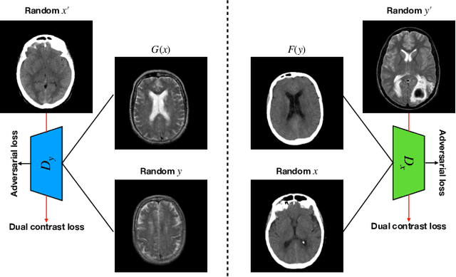 Figure 4 for DC-cycleGAN: Bidirectional CT-to-MR Synthesis from Unpaired Data