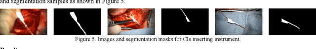 Figure 4 for Self-Supervised Surgical Instrument 3D Reconstruction from a Single Camera Image