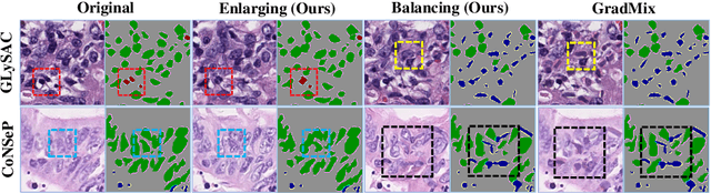 Figure 3 for DiffMix: Diffusion Model-based Data Synthesis for Nuclei Segmentation and Classification in Imbalanced Pathology Image Datasets