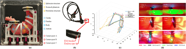 Figure 3 for Motion-Guided Dual-Camera Tracker for Low-Cost Skill Evaluation of Gastric Endoscopy