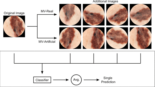 Figure 1 for Using Multiple Dermoscopic Photographs of One Lesion Improves Melanoma Classification via Deep Learning: A Prognostic Diagnostic Accuracy Study