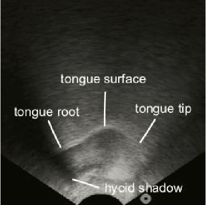 Figure 4 for SottoVoce: An Ultrasound Imaging-Based Silent Speech Interaction Using Deep Neural Networks