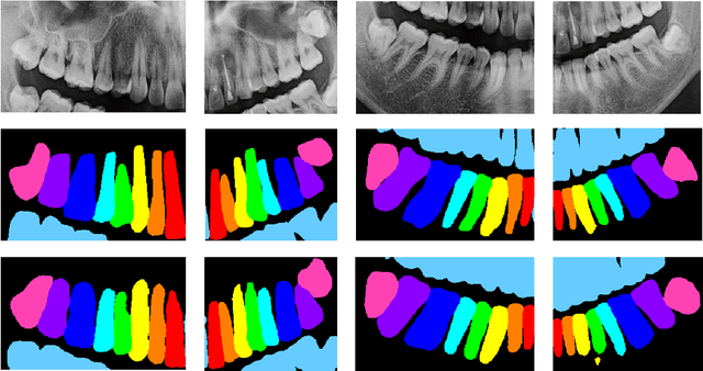 Figure 3 for Intergrated Segmentation and Detection Models for Dentex Challenge 2023
