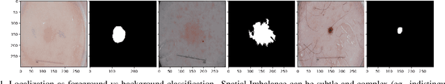 Figure 1 for Attend Who is Weak: Pruning-assisted Medical Image Localization under Sophisticated and Implicit Imbalances