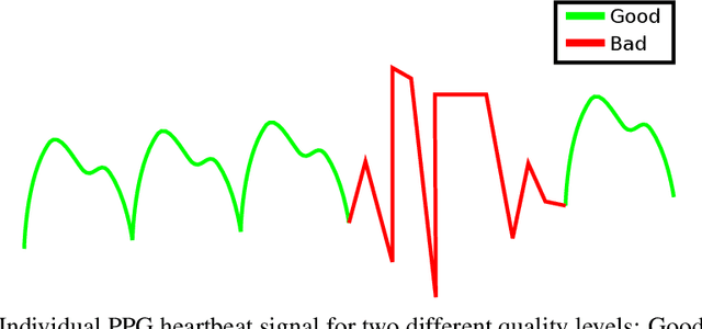 Figure 1 for Quality Assessment of Photoplethysmography Signals For Cardiovascular Biomarkers Monitoring Using Wearable Devices