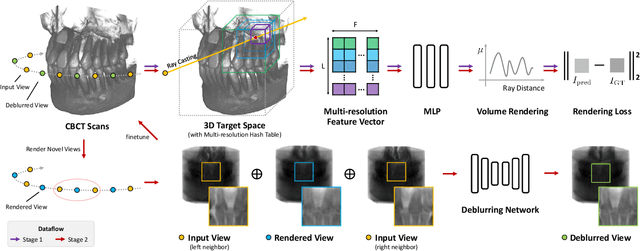Figure 3 for SNAF: Sparse-view CBCT Reconstruction with Neural Attenuation Fields