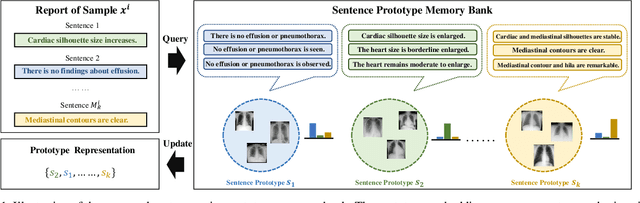 Figure 1 for PRIOR: Prototype Representation Joint Learning from Medical Images and Reports