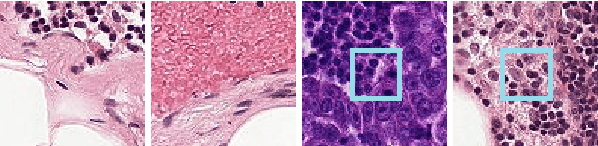 Figure 1 for A Deep Learning-based Compression and Classification Technique for Whole Slide Histopathology Images