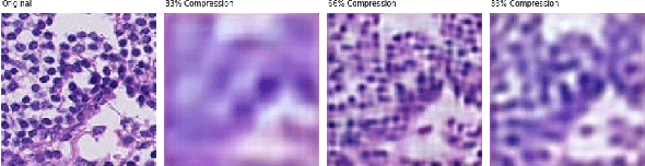 Figure 4 for A Deep Learning-based Compression and Classification Technique for Whole Slide Histopathology Images