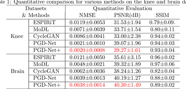 Figure 2 for Deep unfolding as iterative regularization for imaging inverse problems