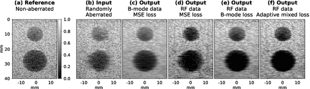 Figure 3 for Phase Aberration Correction: A Deep Learning-Based Aberration to Aberration Approach