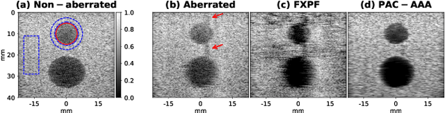 Figure 4 for Phase Aberration Correction: A Deep Learning-Based Aberration to Aberration Approach