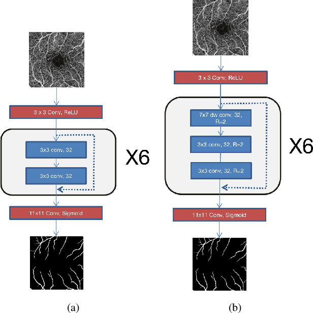 Figure 3 for An Accurate and Efficient Neural Network for OCTA Vessel Segmentation and a New Dataset