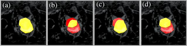 Figure 3 for Automated Ensemble Search Framework for Semantic Segmentation Using Medical Imaging Labels