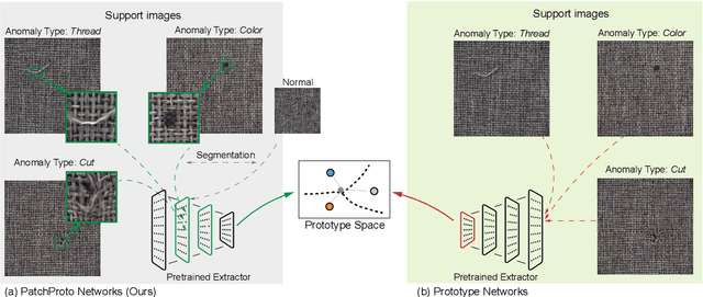 Figure 1 for PatchProto Networks for Few-shot Visual Anomaly Classification