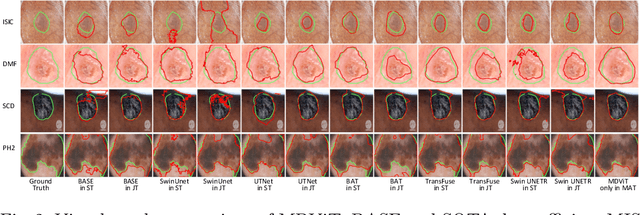 Figure 4 for MDViT: Multi-domain Vision Transformer for Small Medical Image Segmentation Datasets