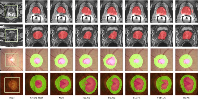 Figure 4 for MLA-BIN: Model-level Attention and Batch-instance Style Normalization for Domain Generalization of Federated Learning on Medical Image Segmentation