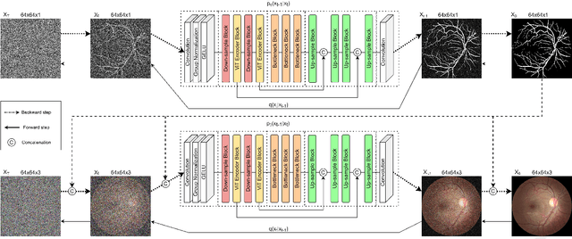 Figure 3 for Denoising Diffusion Probabilistic Model for Retinal Image Generation and Segmentation