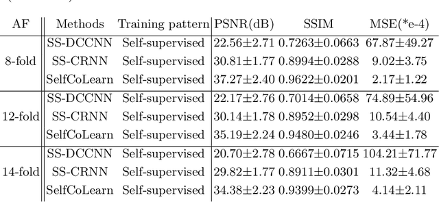 Figure 2 for SelfCoLearn: Self-supervised collaborative learning for accelerating dynamic MR imaging