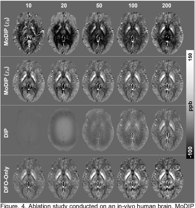 Figure 4 for Quantitative Susceptibility Mapping through Model-based Deep Image Prior (MoDIP)