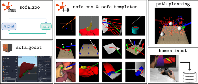 Figure 1 for LapGym -- An Open Source Framework for Reinforcement Learning in Robot-Assisted Laparoscopic Surgery