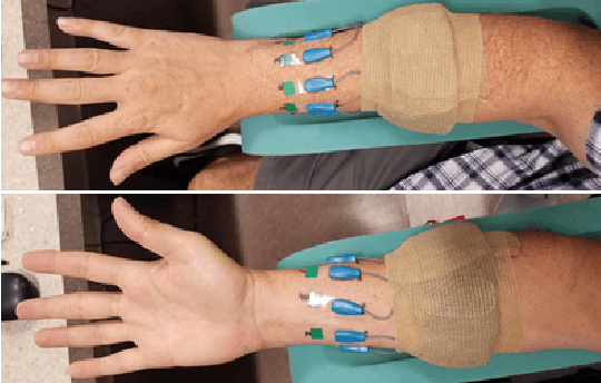 Figure 1 for A Multi-label Classification Approach to Increase Expressivity of EMG-based Gesture Recognition