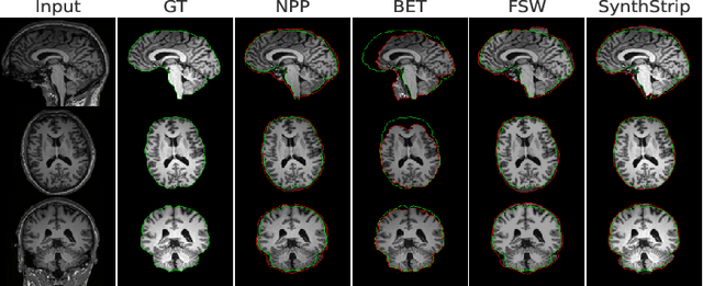 Figure 3 for Neural Pre-Processing: A Learning Framework for End-to-end Brain MRI Pre-processing