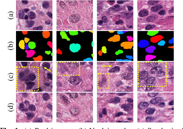 Figure 1 for Enhanced Sharp-GAN For Histopathology Image Synthesis