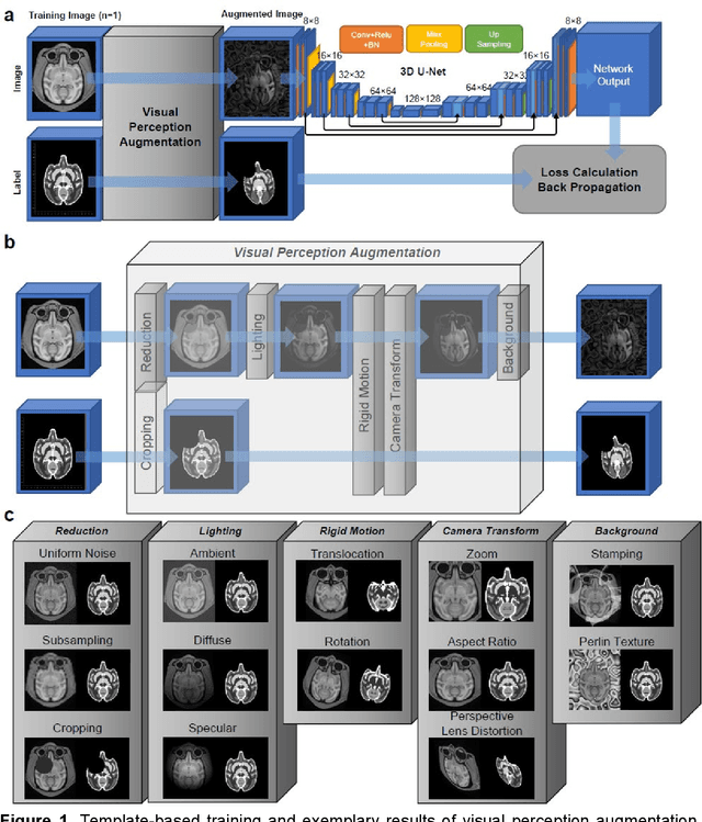 Figure 1 for Brain MRI Segmentation using Template-Based Training and Visual Perception Augmentation