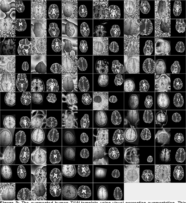Figure 2 for Brain MRI Segmentation using Template-Based Training and Visual Perception Augmentation