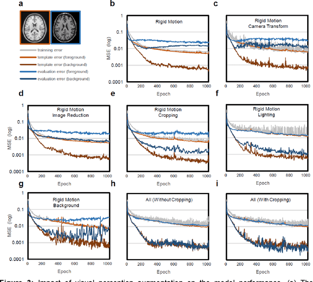 Figure 3 for Brain MRI Segmentation using Template-Based Training and Visual Perception Augmentation