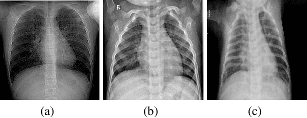 Figure 3 for Deep reproductive feature generation framework for the diagnosis of COVID-19 and viral pneumonia using chest X-ray images