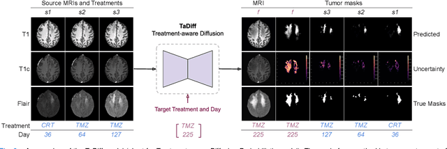 Figure 3 for Treatment-aware Diffusion Probabilistic Model for Longitudinal MRI Generation and Diffuse Glioma Growth Prediction