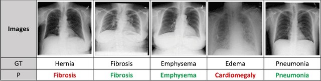 Figure 3 for Few-shot Diagnosis of Chest x-rays Using an Ensemble of Random Discriminative Subspaces