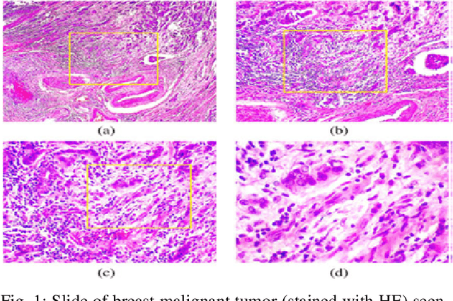 Figure 1 for Exploring Regions of Interest: Visualizing Histological Image Classification for Breast Cancer using Deep Learning