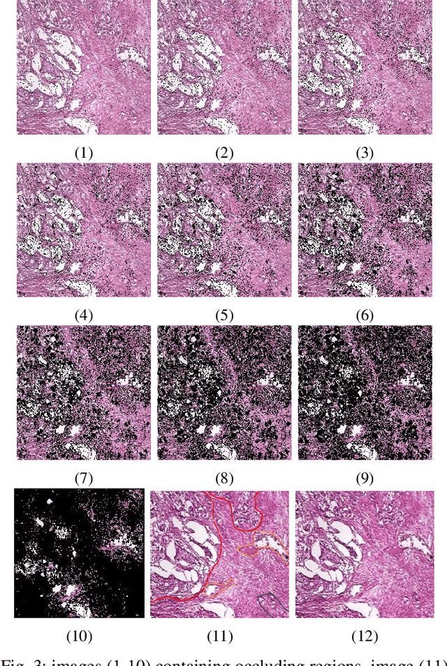 Figure 3 for Exploring Regions of Interest: Visualizing Histological Image Classification for Breast Cancer using Deep Learning