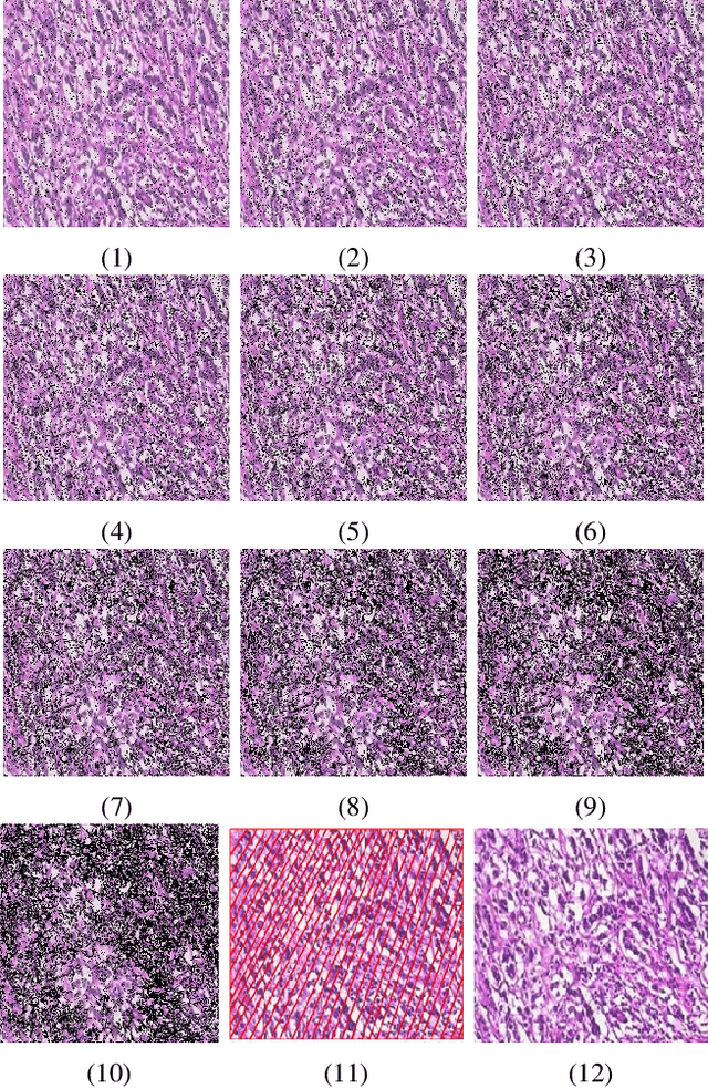 Figure 4 for Exploring Regions of Interest: Visualizing Histological Image Classification for Breast Cancer using Deep Learning