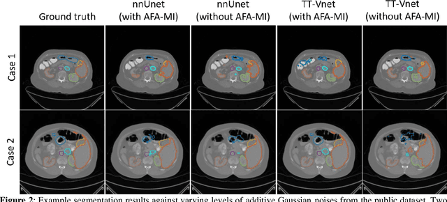 Figure 3 for Deep Learning-based Multi-Organ CT Segmentation with Adversarial Data Augmentation
