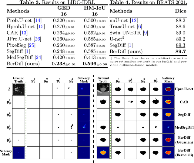 Figure 4 for BerDiff: Conditional Bernoulli Diffusion Model for Medical Image Segmentation